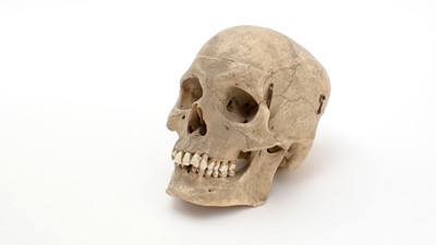 Lot 242A - A human skull
