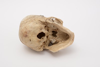 Lot 242 - A human skull